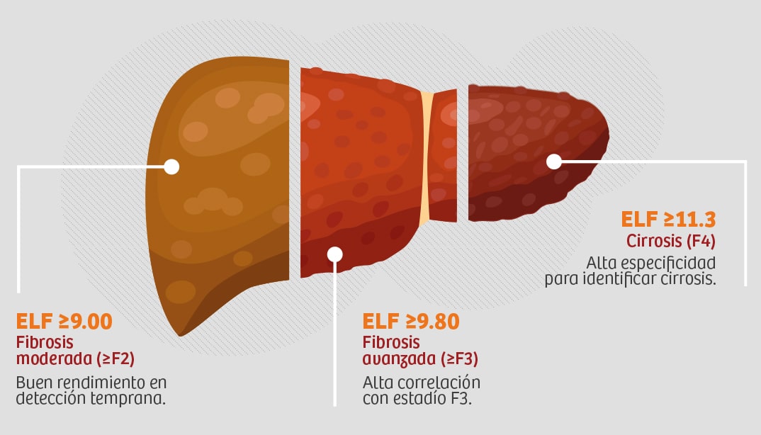 ELF™ • Uso Diagnóstico